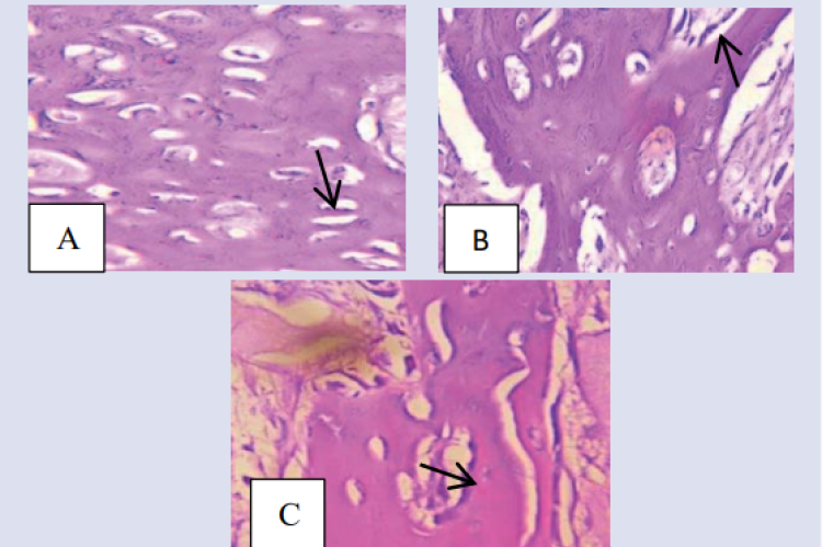 Histopathological description of wistar rat (Rattus norvegicus)  osteoblast cells in the group: (a) negative control, (b) positive control, and  (c) ramania leaf extract gel with a concentration of 15% on day 14 after  tooth extraction.