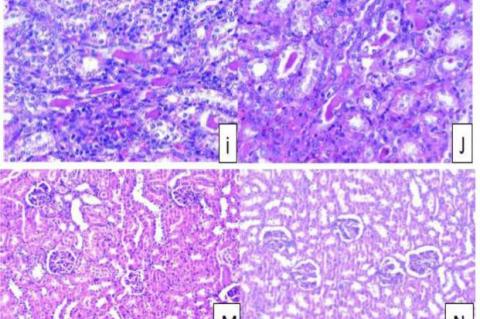 Section in kidney tissue of cisplatin -treated rat preceded by MeOH extract of C. Pepo and L. Camara