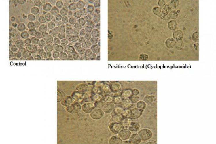 Morphology of COLO 320 cells after 24 h treatment with Caralluma fimbriata (200x) Caralluma fimbriata treated cells (300 μg )