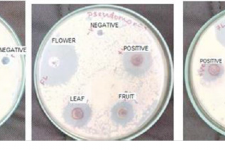 Antibacterial activity of silver nanoparticles.