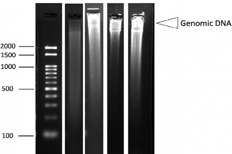 DNA Ladder Assay for Detection of Apoptosis in HeLa Cells Treated with Macroalgae Extracts
