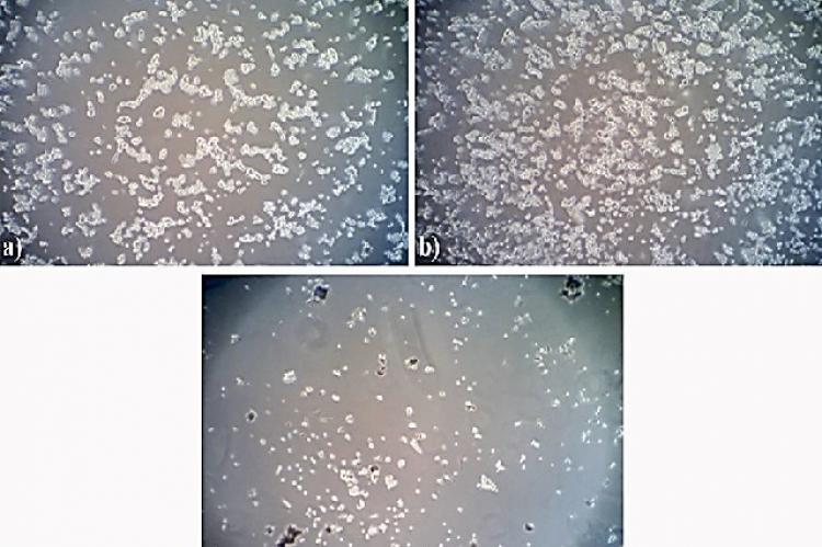 Phase contrast photomicrograph (10x) of SH-SY5Y cell viability by MTT assay