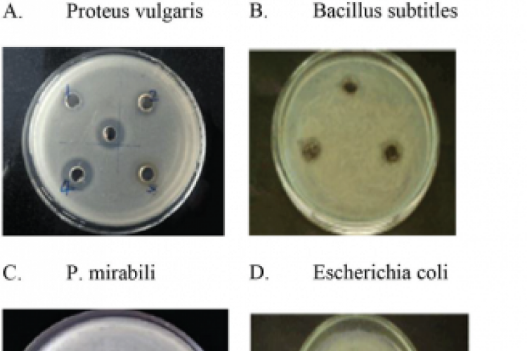 Antibacterial activity against different bacterial strains