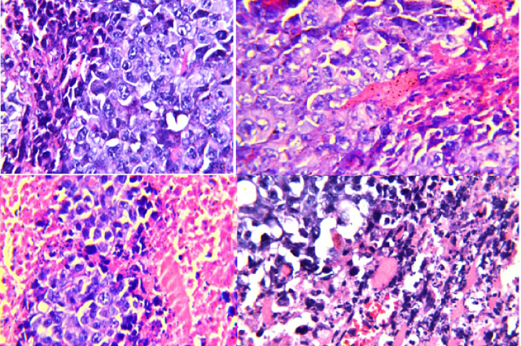 Photomicrographs of sections in solid Ehrlich carcinoma (EC) stained by H and E. (A): Section in muscular tissue of EC bearing mice; (B): Section in muscular tissue of EC treated with RS extract; (C): Section in muscular tissue of EC treated with gamma irradiation; (D): Section in muscular tissue of EC treated with RS extract and gamma irradiation, H and E, ×80.
