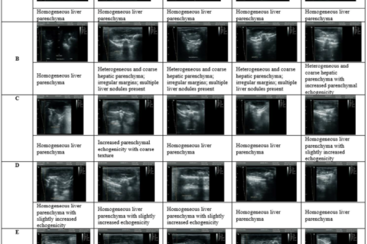 Representative ultrasonographic images of rat livers. Group A = Normal control; Group B = CCl₄ control; Group C = Coffea arabica 100 mg/kg BW; Group D = Coffea arabica 200 mg/kg BW; Group E = Coffea arabica 300 mg/kg BW