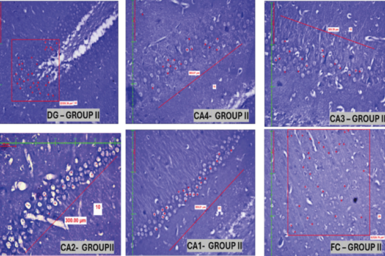 Figure represents the Group 1& 2:AS group- dentate gyrus (150 x 150 sq μm2 area), the Cornu ammonis (300 sq μm length area - CA 1 to CA4) parts of the hippocampus, and Frontal Cortex ( 250 x 250 sq μm2 area FC) respectively