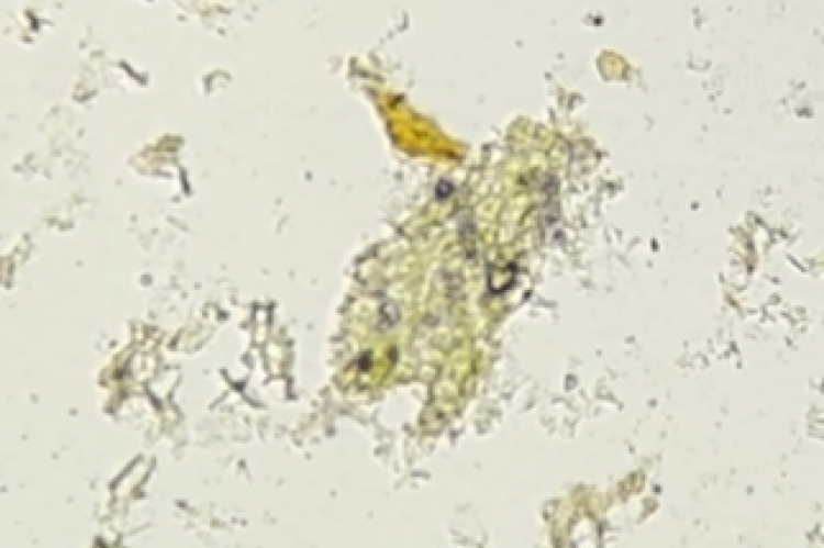 Endosperm of fennel