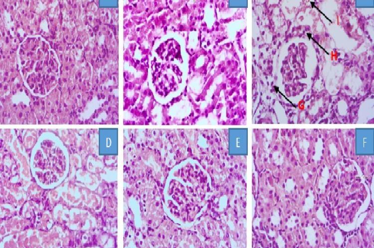 Histopathology kidney (A)Normal control, (B) Positive control, (C)Negative control, (D) dose 50 mg/kg, (E) Dose 100 mg/kg, (F) dose 200 mg/kg, (G) Necrosis cell, (H) Narrowing / closing proximal tubules, (I) Casts