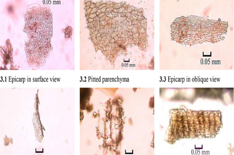 Microscopy of powder of Cichorium intybus fruit