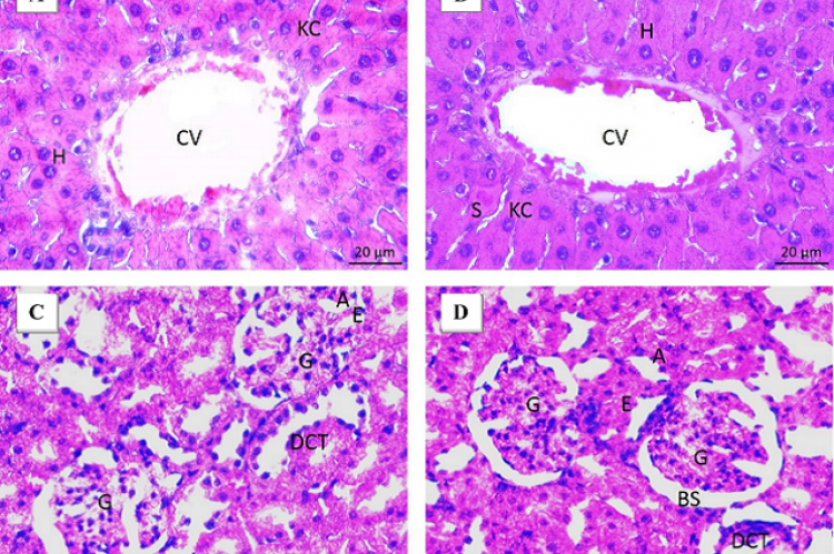 Light photomicrograph of liver and kidney sections from control and treated groups