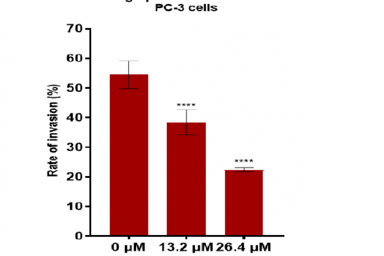 Shows the bar chart for invasion rate of PC3 cells treated with different concentration of andrographolide, 0 μM (as the control),