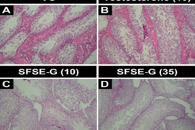 Photomicrographs of sections of representative testes of male rats showing the effects of subacute administration