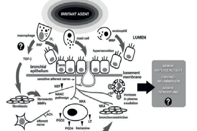 RADS pathophysiology hypothesis 24.