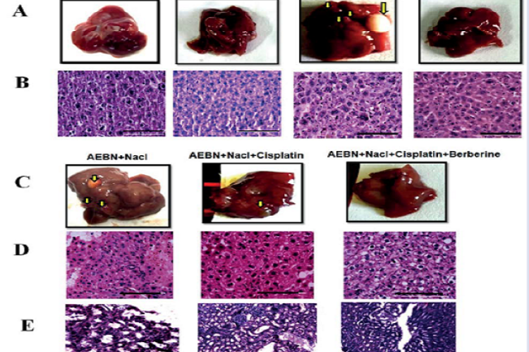 Berberine administered alone or in combination with cisplatin reduced liver nodulation (A) & (C) and restored restored tissue architecture of the liver (B) & (D) and the kidneys (E) in the indicated treatment groups. Scale bar = 100 μm. Number of mice, n= 30 per treatment group.