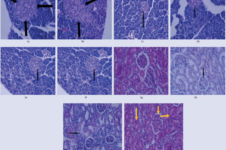 Pancreas of normal rats that received distilled water (GI) (H & E stain x 400). Figure 1b. Pancreas of normal rats that received chamomile extract (150 mg/kg) (GII) (H & E stain x 400). Figure 1c. Pancreas of diabetic rats received distilled water (GIII) (H & E stain x 400) Figure 1d. Pancreas of diabetic rats that received chamomile extract (150 mg/kg) (GIV) (H & E stain x 400). Figure 1e. Pancreas of diabetic rats that received chamomile extract (300 mg/kg) (GV) (H & E stain x 400). Figure 1f. Kidney of n