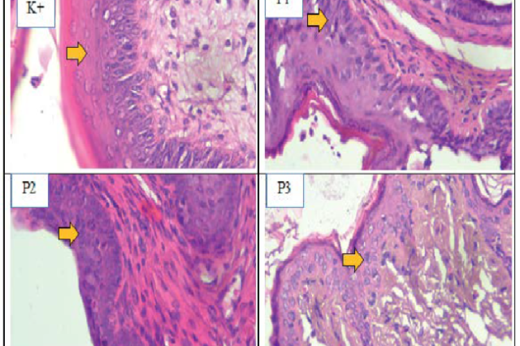 Histological depiction of vaginal epithelial thickness in each Control and Treatment group administered with extract of Phyllanthus niruri l. in a mouse model of menopause.