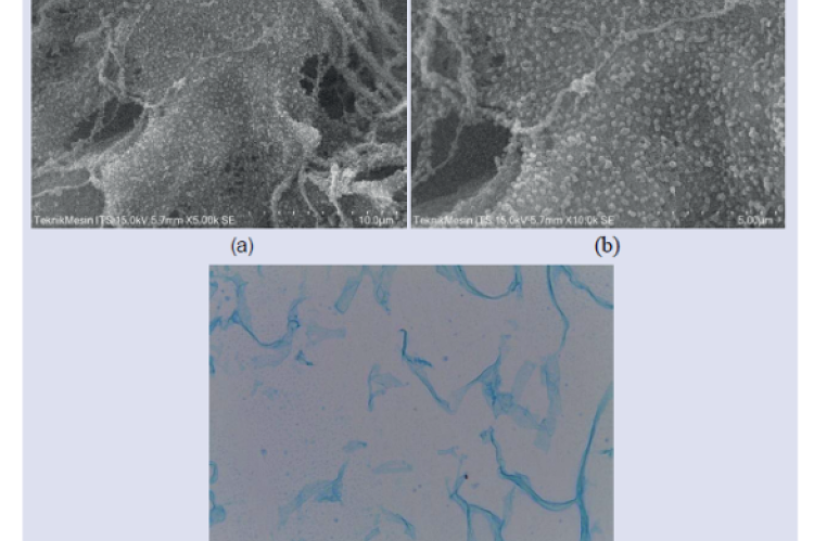 Scanning electron microscope images of 5,000x (a) and 10,000x (b) magnification showed that the cells not only adhered to the surface but also penetrated the porous structure of the 3D medium. Alcian blue staining is to visualize and identify glycosaminoglycans (GAGs), as these are critical components of the extracellular matrix in cartilage (c).