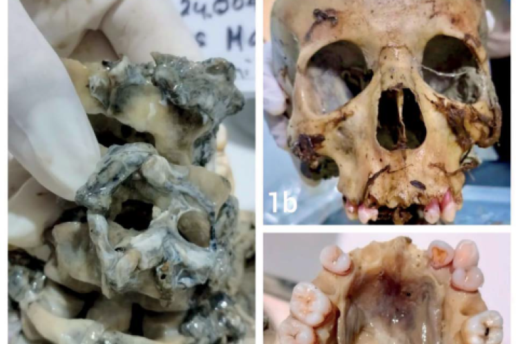 Bone examination. The examination focuses on the cervical bones 1-4 (a), skull (b), and upper jaw (c).