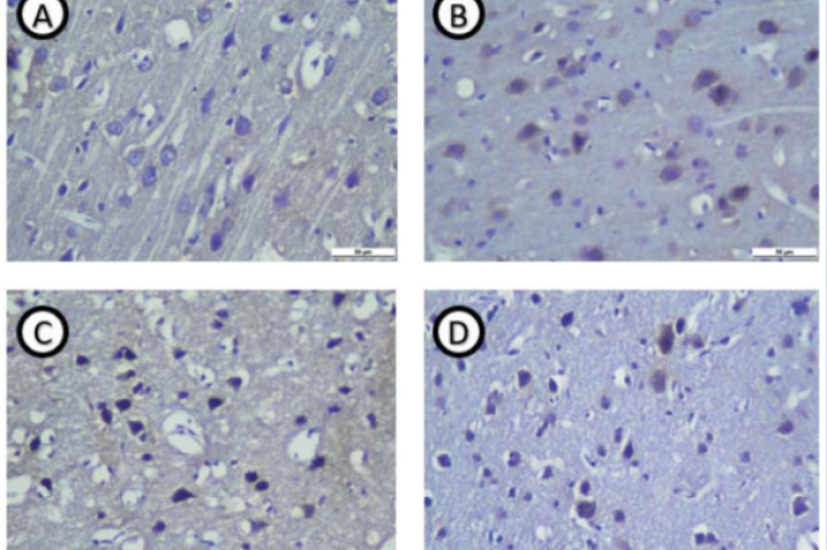 Expression NGF immunohistochemistry 24 hours post treatment in the group without treatment ( weak intensity : +) (A) treatment group  without Kaempferia galanga L extract (medium intensity: ++) (B) treatment group and received 600 mg/kgbb Kaempferia galanga L extract (medium  intensity: ++) (C) group treatment and received 1200 mg/kgbb Kaempferia galanga L extract (strong intensity: +++) (D) (40 times magnification).