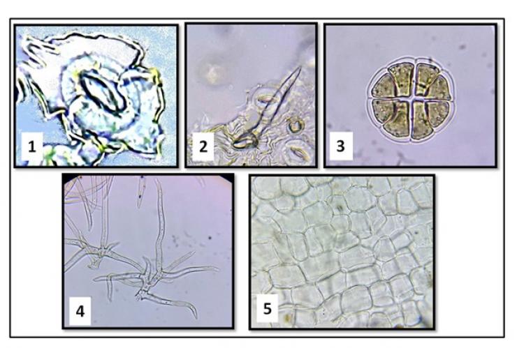 Illustration for microscopic examination of powdered Rosemary leaves. Lower epidermis with diacytic stomata (1); conical shaped covering trichomes (2); labiate type glandular trichome (3); branched covering trichomes (4); upper epidermis of the leaf (5).
