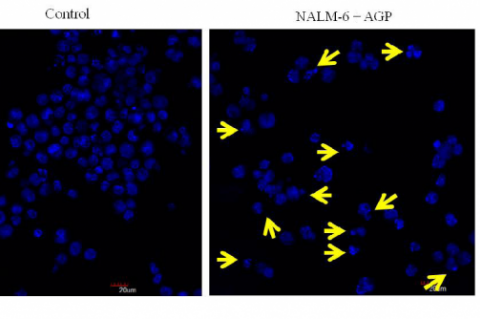 Detection of nuclear fragmentation in NALM-6 cells after AGP treatment. NALM-6 cells were treated with and without AGP (IC50) for 48h, stained with DAPI and visualized under fluorescence microscope.
