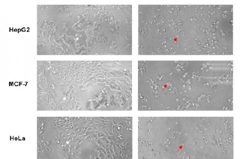 Cell morphology of HepG2, MCF-7 and HeLa cells after treatment with 1000 μg/mL of L. plantarum KK518 extract over 48 h of exposure compared to the untreated cells