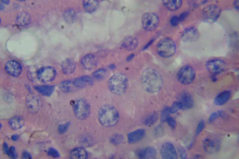 Kidney slides at 72 hours. The figure at the left represents a blank control group section without modifications at 400X. The figure at the right represents the experimental group (Aniba canelilla 2000mg/kg) section without modifications at 400X.