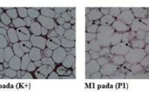 Immunohistochemistry (IHC) staining results of M1 quantity.