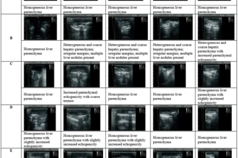 Representative ultrasonographic images of rat livers. Group A = Normal control; Group B = CCl₄ control; Group C = Coffea arabica 100 mg/kg BW; Group D = Coffea arabica 200 mg/kg BW; Group E = Coffea arabica 300 mg/kg BW