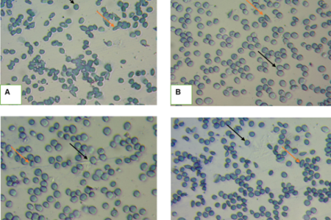 Photomicrographs of erythrocyte morphology under different treatments at 60th minute reading, Mag.x40. The sickled shape of red cells is illustrated by a yellow arrow, and normal RBCs by a black arrow. (A) - The reversal effect of NS on SS-RBC morphology. (B) - The reversal effect of PABA on SS-RBC morphology. (C) - The reversal effect of JCL 20 mg/mL on SS-RBC morphology. (D) - The reversal effect of JCS 20 mg/mL on SS-RBC morphology.