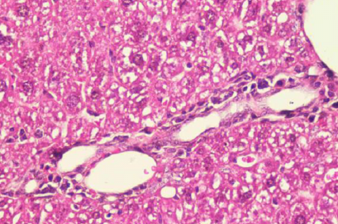 Histological findings in the liver. (a) Sublobular vein; (b) Interlobular vein; (c) Centralis vein; (d) Interlobular duct;  Hepatocyte form;  Focal necrosis;  Hypertrophy;  Fibrosis;  Cholestasis;  Steatosis