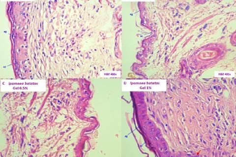 Histopathological sections of the skin of Mus musculus Balb / c. A. Group I (Control). B. Group II. (Base Gel). C. Group III (Gel I. batatas 0.5%). D. Group IV (Gel I. batatas 1%). Keratinous stratum corneum (ec), stratum granulosa (eg), stratum spinosum (ee), basal cells (eb) dermal papillae (arrow), fibroblasts (*), sweat glands (gs), eschar (s). (Hematoxylin and Eosin stained, 400X).