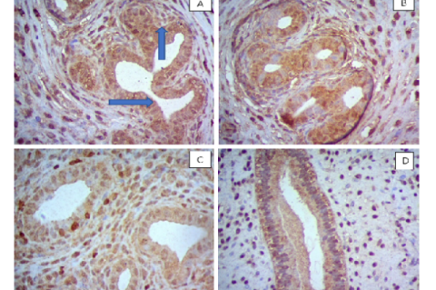 Immunohistochemical staining for EG-VEGF in rat endometrium. Their location is detected in the epithelial cells of the glands and stroma. A. Natural cycle, B, Stimulated cycle with a dose of 12.5 IU and C, Stimulated cycle with a dose of 25 IU,