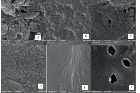 A) Artificial saliva group (control), (B) 0.5% MgCl2 gel group, (C) 0.5% MgCl2 gel and diode laser, (D) 1% MgCl2 gel group, (E) 1% MgCl2 gel group and diode laser , (F) 1.23% APF gel.