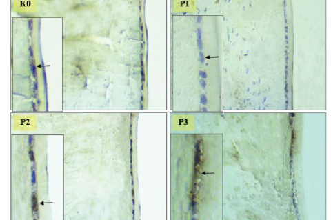 The arrows point to lens epithelial cells that contain CAT. The P1 group appeared to be the weakest compared to the other treatment groups.