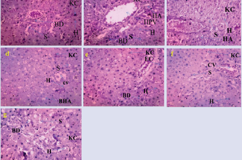 Effects of explants of Coccinia grandis plant parts (leaf, stem) and callus (leaf, stem) extracts on structural changes in liver tissue of normal control and treated groups of Albino Wistar rats. (3a) Normal architecture in normal control groups. (3b) A Representative section of the liver from the CCl4-treated group shows centrilobular vacuolar degeneration of hepatocytes and parenchymal tissue. (3c) Representative section treated with silymarin, a standard drug. Representative sections treated with plant p