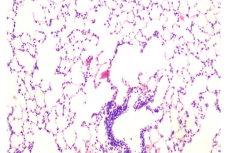 Histopathology of lung tissue consisting of alveoli and bronchioles