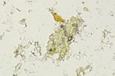 Endosperm of fennel