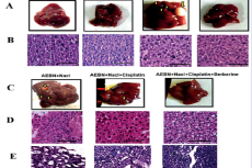 Berberine administered alone or in combination with cisplatin reduced liver nodulation (A) & (C) and restored restored tissue architecture of the liver (B) & (D) and the kidneys (E) in the indicated treatment groups. Scale bar = 100 μm. Number of mice, n= 30 per treatment group.