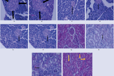 Pancreas of normal rats that received distilled water (GI) (H & E stain x 400). Figure 1b. Pancreas of normal rats that received chamomile extract (150 mg/kg) (GII) (H & E stain x 400). Figure 1c. Pancreas of diabetic rats received distilled water (GIII) (H & E stain x 400) Figure 1d. Pancreas of diabetic rats that received chamomile extract (150 mg/kg) (GIV) (H & E stain x 400). Figure 1e. Pancreas of diabetic rats that received chamomile extract (300 mg/kg) (GV) (H & E stain x 400). Figure 1f. Kidney of n